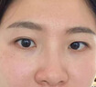 Newliann醫(yī)用重組三型人源化膠原蛋白乳液修復敷料凝膠人表皮生長因子面霜 曬單實拍圖