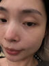 颯望德國黑頭儀吸黑頭小氣泡儀器超強吸力超強清潔電動(dòng)吸黑頭粉刺收縮毛孔家用小氣泡美容儀器去粉刺 【清潔款】真空負壓吸出黑頭 曬單實(shí)拍圖