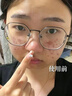 川廿制藥祛痘藥膏淡化痘印消炎痤瘡專用去痘痘和痘印修復后背部青春痘凝膠 曬單實拍圖