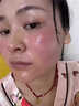 華美科醫用修復皮膚屏障保濕面霜女士男士械字號敏感肌受損泛紅修護補水 曬單實(shí)拍圖