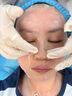 沃朗森醫用面膜型械字號醫美術(shù)后修復保濕補水消炎冷敷貼膠原蛋白 3盒 曬單實(shí)拍圖