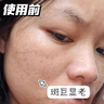 透真377美白祛斑淡化黑色素雀斑抗皺緊致淡紋面部玫瑰精華油去黃次拋 曬單實(shí)拍圖