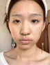北京同仁堂痘印痘坑修復凹洞填充再生非藥乳膏祛痘印淡化消除男生去痘印痘疤 單盒【官方正品】 曬單實(shí)拍圖