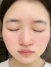 Newliann醫(yī)用重組三型人源化膠原蛋白乳液修復(fù)敷料凝膠人表皮生長因子面霜 曬單實拍圖