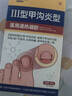 Newliann醫用甲溝炎消腫專(zhuān)用工具息肉紅腫去肉芽嵌甲發(fā)炎化膿膏矯正器制藥 曬單實(shí)拍圖