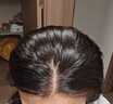 【第二代米諾地爾】蔓迪5%生發(fā)泡沫劑60g*3（倍速生發(fā) 溫和不起痘）男女士專(zhuān)用治脫發(fā)防脫育發(fā)米洛原液酊搽劑 曬單實(shí)拍圖