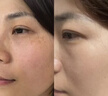 ZHENMI新加坡進(jìn)口美白祛斑面霜男女煙酰胺護(hù)膚提亮淡黑色素補(bǔ)水保濕滋潤(rùn) 曬單實(shí)拍圖