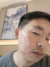 同仁堂祛痘膏去痘印修復淡化痘印痘坑20g中秋 曬單實(shí)拍圖