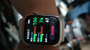 華為（HUAWEI）手表WATCH D2【咨詢享優(yōu)惠】腕部心電血壓采集記錄儀家用血氧睡眠壓力體溫監(jiān)測運動健康家人禮物 晨曦金【送保護(hù)膜+曬單十選一】 曬單實拍圖