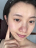 ELL清潔泥膜紫蘇壬二酸控油祛痘收毛孔粗大保濕舒緩緊致肌膚涂抹面膜 【拍1發(fā)12】二代泥膜+精華組合 曬單實(shí)拍圖