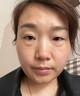 碧素堂眼袋貼祛眼袋消除重度嚴重中老年專(zhuān)用眼霜男女士大眼袋去除神器 眼袋消腫液克星：一盒裝 提拉緊致抗皺淡化黑眼圈膜第一名 曬單實(shí)拍圖
