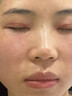 維特絲愈創(chuàng  )木祛痘控油修護保濕乳液淡化痘印去痘痘收縮毛孔男女士護膚品 曬單實(shí)拍圖