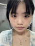 dyey點(diǎn)痣膏無(wú)痕去痣黑痣瘊子點(diǎn)痣液扁平尤絲狀尤尖尤肉刺肉兒童可用 曬單實(shí)拍圖