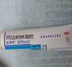 【原研好藥】達芙文 阿達帕林凝膠0.1%*30g/盒用于以粉刺丘疹和膿皰為主要表現的輕中度尋常型痤瘡 曬單實(shí)拍圖