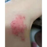 香港大藥房爐甘石止癢香皂全身皮膚瘙癢皮炎濕疹真菌感染爐甘石抑菌止癢膏藥 單盒裝【一洗止癢】 爐甘石藥皂去痱子外用沐浴露 曬單實(shí)拍圖