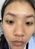儒意面部精華液美白抗皺緊致改善暗沉提亮氨甲環(huán)酸淡斑褪黑淡痘印禮盒 30支/盒 【修紅敏】醫研5%氨甲環(huán)酸 曬單實(shí)拍圖