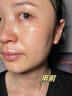 韓方五谷377美白補水保濕精華液次拋祛斑提亮去黃護膚品抗氧煙酰胺男女士 曬單實(shí)拍圖