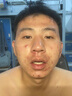 YYTISS祛痘淡化痘印去痘痘和痘印黑色素沉淀痘坑修疤復青春痘祛痘膏學生 曬單實拍圖
