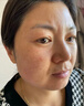 同仁堂美白祛斑霜淡化黑色素去斑雀斑黃褐斑老年斑曬斑煙酰胺男女士面霜 1瓶裝【適合任何膚質(zhì)使用】 曬單實(shí)拍圖
