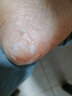 卡貝娜（Kabeina）腳后跟干裂修復霜手足龜裂開(kāi)裂皸裂治起皮去死皮潤馬油皺裂膏 1瓶【滋養修護 保濕滋潤】 曬單實(shí)拍圖