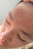 YYTISS祛痘藥膏淡化痘印消除坑炎痤瘡專(zhuān)用青少年去痘痘和痘印青春痘學(xué)生 曬單實(shí)拍圖