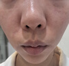極萌【明星推薦】水光儀抗衰補水祛黃提亮淡紋膠原炮美容儀水光針原液自打儀器全能彈價保雙11 曬單實拍圖