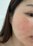 普門科技醫(yī)用大排燈美容儀紅藍(lán)黃光治療敏感肌痘痘痤瘡消炎七夕禮物送女友 光E【三光+12模式】 曬單實(shí)拍圖