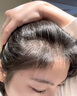 半桃防脫育發(fā)液100ml防掉發(fā)增長濃密固發(fā)際線激活頭皮毛囊養(yǎng)護精華液 曬單實拍圖