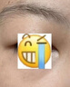 皮脂腺囊腫脂肪瘤專用特消除囊腫膿包效藥硬塊臉上起痘痘疙瘩皮下粉瘤囊腫去i除痤瘡拔毒火癤子莫匹羅星軟膏 1盒【皮脂腺囊腫專用藥膏】 曬單實拍圖