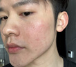 Losoki瑞士進(jìn)口氨基酸洗面奶美白控油祛痘除螨蟲去黑頭男女士專用潔面乳 曬單實(shí)拍圖