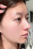 Newliann醫用黑面膜械字號祛痘祛痘印術(shù)后消炎修復醫美美白補水修護男士女 曬單實(shí)拍圖