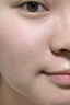 醫用精華液械字號收縮毛孔粗大修復細致去黑頭粉刺閉口男士女士祛痘印黑色素沉淀控油淡化痘印痘坑透明質(zhì)酸鈉 曬單實(shí)拍圖