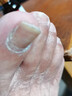 ASHK灰指甲專用重度指甲特效脫甲壞甲發(fā)黃發(fā)白增厚膏藥抑菌液30ml*1瓶 曬單實拍圖