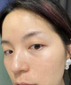 Newliann醫用重組三型人源化膠原蛋白外用人表皮生長(cháng)因子凝膠皮膚疤痕修復 曬單實(shí)拍圖