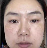 泊紫汀蘭377美白祛斑霜淡化黑色素去雀斑黃褐斑提亮改善暗沉保濕面霜乳液 曬單實(shí)拍圖