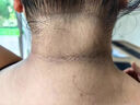 TVLV脖子黑色素去除黑棘皮癥治黑脖子病克星肘部腋下黑皮去黑專(zhuān)用膏藥 多維美白透亮嫩膚頸霜 曬單實(shí)拍圖