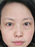 Losoki瑞士進(jìn)口眼膜京東自營(yíng)淡紋眼膜貼眼袋提拉緊致抗皺淡化黑眼圈 曬單實(shí)拍圖
