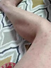 身上皮膚癢秋冬季后背手臂大腿干癢起紅疙瘩長(cháng)小紅點(diǎn)抑菌止癢軟膏 一盒裝 曬單實(shí)拍圖