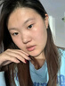 維特絲壬二酸祛痘藥膏煙酰胺凝膠去痘痘粉刺閉口男女水楊酸收毛孔青少年 曬單實(shí)拍圖