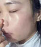 清熱暗瘡丸祛痘痘粉刺痘印醫用痤瘡中藥去青春痘紅腫硬疙瘩痘印消炎膿皰去痘印青少年痤瘡專(zhuān)用藥【視覺(jué)特效】 1盒【國藥正品】標準裝 曬單實(shí)拍圖