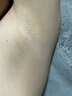 康佳（KONKA）藍(lán)寶石3301脫毛儀冰點(diǎn)感激光剃毛器儀女身體四肢家用女大學(xué)生日禮物 七夕保價(jià)實(shí)用 【國家補(bǔ)貼】16.8J旗艦版藍(lán)寶石MAX 曬單實(shí)拍圖