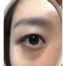協(xié)和黑眼圈重度去除黑色素去黑眼圈專(zhuān)用眼部黑色素沉淀男女士淡化眼霜 單盒裝【黑眼圈眼袋患者專(zhuān)用】 淡化細紋提拉緊致祛黑眼圈眼袋貼 曬單實(shí)拍圖