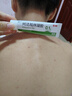 麗芙阿達帕林凝膠35g/盒第三代維a酸乳膏醫用祛痘印修復淡化痘印痘坑修復祛痘藥膏去黑頭收縮毛孔粗大修復 曬單實(shí)拍圖