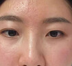 Newliann醫(yī)用重組三型人源化膠原蛋白乳液修復敷料凝膠人表皮生長因子面霜 曬單實拍圖