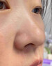 尤維佳維A酸乳膏醫用去黑頭閉口收縮毛孔 鼻子鼻頭粉刺清理 皮膚用藥祛痘消炎痤瘡草莓鼻男女士專(zhuān)用藥膏 1+1維生素b6軟膏 【醫用去黑頭】 曬單實(shí)拍圖