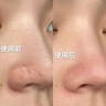 維特絲（vetes）去角質(zhì)面部啫喱控油保濕洗面奶男女士清潔毛孔黑頭閉口溫沒(méi)激素和 【6大專(zhuān)利】果酸去角質(zhì)啫喱200g 曬單實(shí)拍圖