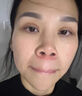 云南白藥 泰邦 TB鼻炎貼穴位貼敷急慢性鼻炎鼻塞流涕鼻癢鼻不適消炎成人膏藥貼 曬單實(shí)拍圖
