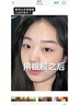 Losoki瑞士進(jìn)口眼膜京東自營(yíng)淡紋眼膜貼眼袋提拉緊致抗皺淡化黑眼圈 曬單實(shí)拍圖