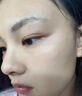 醫用精華液械字號收縮毛孔粗大修復細致去黑頭粉刺閉口男士女士祛痘印黑色素沉淀控油淡化痘印痘坑透明質(zhì)酸鈉 曬單實(shí)拍圖
