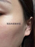 DRVIALY脂肪瘤專(zhuān)用特姣藥脂肪康貼脂肪粒去除藥膏皮下多發(fā)性囊腫硬包塊 3盒療程裝【消脂肪瘤神器特效果】 曬單實(shí)拍圖